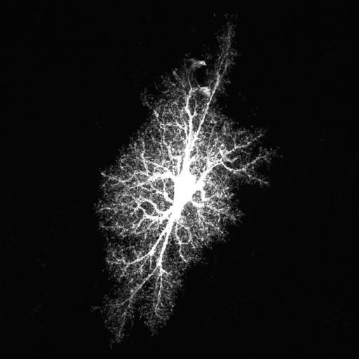  NCBI Organism:Rattus norvegicus; Cell Types:astrocyte, astrocyte of the hippocampus; Cell Components:cell projection cytoplasm, cell body; Biological process:forebrain astrocyte development, cell projection organization;