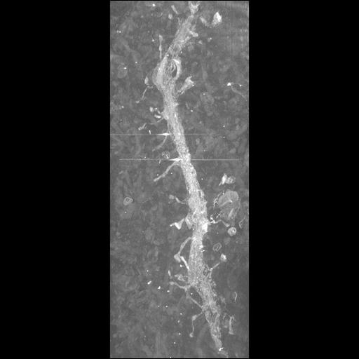  NCBI Organism:Mus musculus; Cell Types:CNS neuron (sensu Vertebrata) Cell Components:dendritic spine, dendrite;