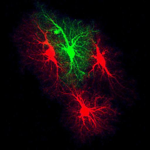  NCBI Organism:Rattus norvegicus; Cell Types:astrocyte Cell Components:cell projection cytoplasm, cell body; Biological process:forebrain astrocyte development, cell projection organization;