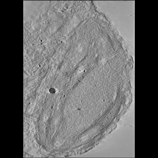  NCBI Organism:Phaeocystis antarctica; Cell Components:thylakoid, chloroplast; Biological process:photosynthetic electron transport chain, thylakoid membrane organization;