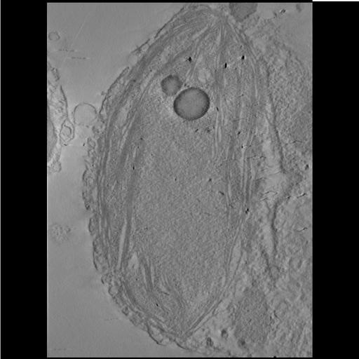  NCBI Organism:Phaeocystis antarctica; Cell Components:thylakoid, chloroplast; Biological process:photosynthetic electron transport chain, thylakoid membrane organization;