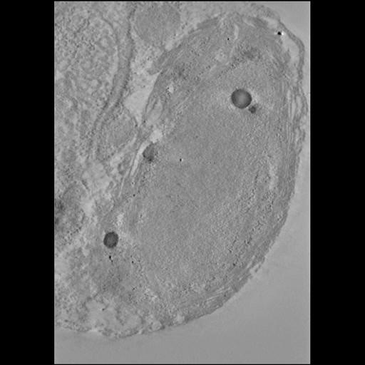  NCBI Organism:Phaeocystis antarctica; Cell Components:thylakoid, chloroplast; Biological process:photosynthetic electron transport chain, thylakoid membrane organization;