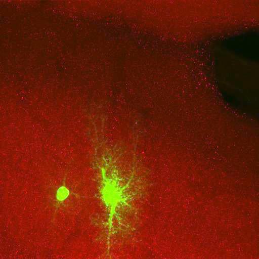  NCBI Organism:Rattus norvegicus; Cell Types:astrocyte, astrocyte of the hippocampus; Cell Components:cell projection cytoplasm, cell body; Biological process:forebrain astrocyte development