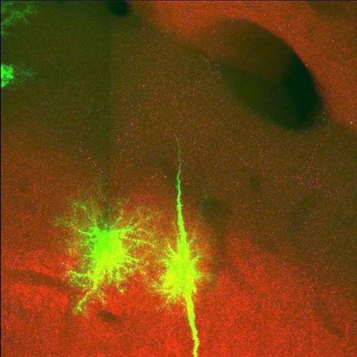  NCBI Organism:Rattus norvegicus; Cell Types:astrocyte, astrocyte of the hippocampus; Cell Components:cell projection cytoplasm, cell body; Biological process:forebrain astrocyte development