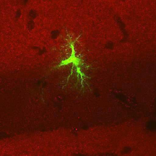  NCBI Organism:Rattus norvegicus; Cell Types:astrocyte, astrocyte of the hippocampus; Cell Components:cell projection cytoplasm, cell body; Biological process:forebrain astrocyte development