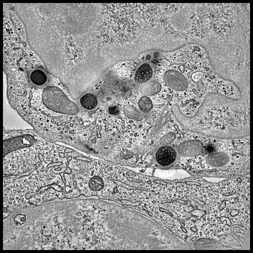  NCBI Organism:Homo sapiens; Cell Types:cytotoxic T cell, lymphocyte; Cell Components:immunological synapse