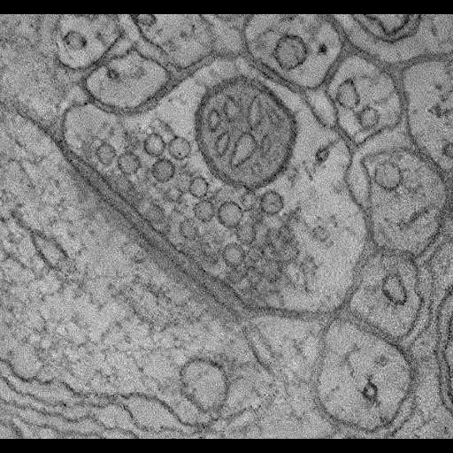  NCBI Organism:Rattus norvegicus; Cell Types:Purkinje cell Cell Components:synapse, dendritic spine, presynaptic active zone;