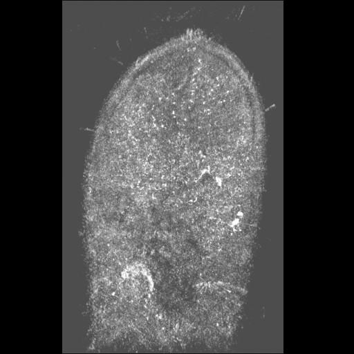  NCBI Organism:Caulobacter crescentus CB15; Cell Types:prokaryotic cell