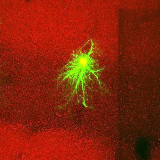  NCBI Organism:Rattus norvegicus; Cell Types:astrocyte, astrocyte of the hippocampus; Cell Components:cell projection cytoplasm, cell body; Biological process:forebrain astrocyte development