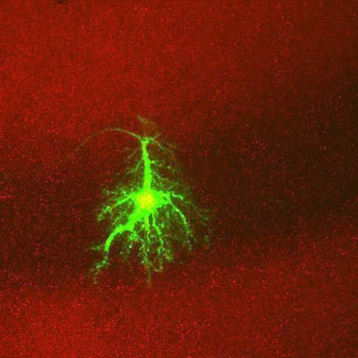  NCBI Organism:Rattus norvegicus; Cell Types:astrocyte, astrocyte of the hippocampus; Cell Components:cell projection cytoplasm, cell body; Biological process:forebrain astrocyte development