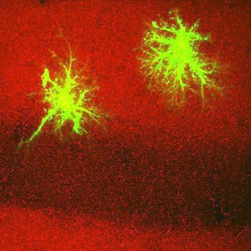  NCBI Organism:Rattus norvegicus; Cell Types:astrocyte, astrocyte of the hippocampus; Cell Components:cell projection cytoplasm, cell body; Biological process:forebrain astrocyte development