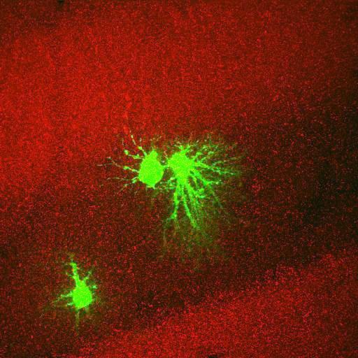  NCBI Organism:Rattus norvegicus; Cell Types:astrocyte, astrocyte of the hippocampus; Cell Components:cell projection cytoplasm, cell body; Biological process:forebrain astrocyte development