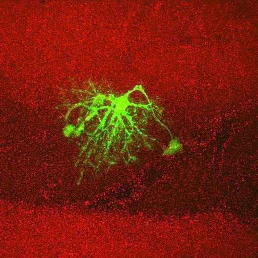  NCBI Organism:Rattus norvegicus; Cell Types:astrocyte, astrocyte of the hippocampus; Cell Components:cell projection cytoplasm, cell body; Biological process:forebrain astrocyte development