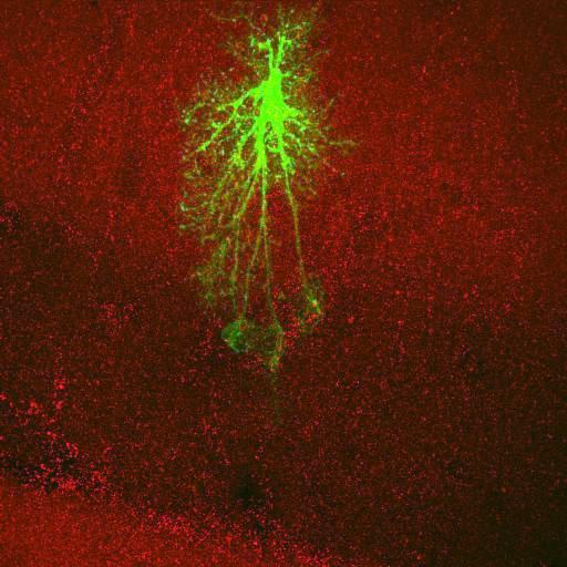  NCBI Organism:Rattus norvegicus; Cell Types:astrocyte, astrocyte of the hippocampus; Cell Components:cell projection cytoplasm, cell body; Biological process:forebrain astrocyte development