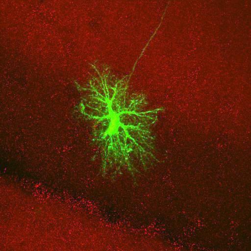  NCBI Organism:Rattus norvegicus; Cell Types:astrocyte, astrocyte of the hippocampus; Cell Components:cell projection cytoplasm, cell body; Biological process:forebrain astrocyte development