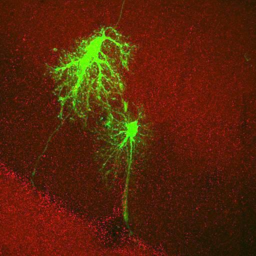  NCBI Organism:Rattus norvegicus; Cell Types:astrocyte, astrocyte of the hippocampus; Cell Components:cell projection cytoplasm, cell body; Biological process:forebrain astrocyte development