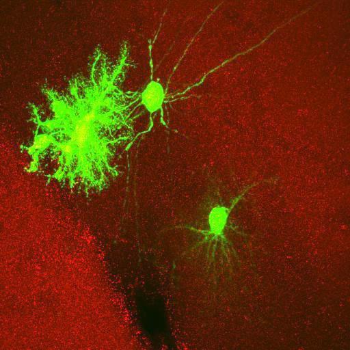  NCBI Organism:Rattus norvegicus; Cell Types:astrocyte, astrocyte of the hippocampus; Cell Components:cell projection cytoplasm, cell body; Biological process:forebrain astrocyte development