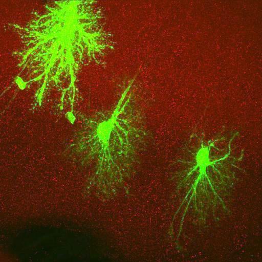  NCBI Organism:Rattus norvegicus; Cell Types:astrocyte, astrocyte of the hippocampus; Cell Components:cell projection cytoplasm, cell body; Biological process:forebrain astrocyte development