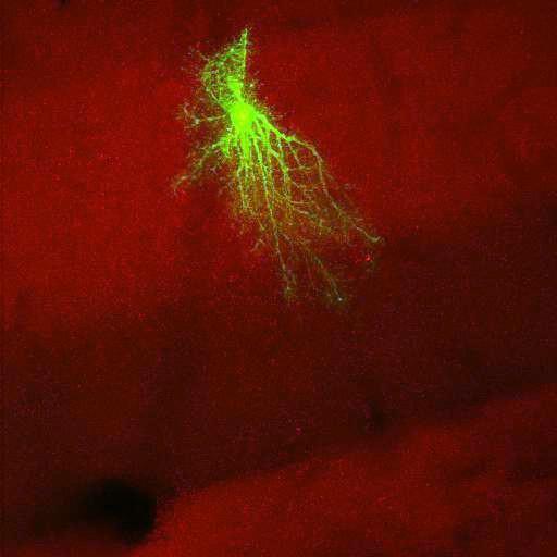  NCBI Organism:Rattus norvegicus; Cell Types:astrocyte, astrocyte of the hippocampus; Cell Components:cell projection cytoplasm, cell body; Biological process:forebrain astrocyte development