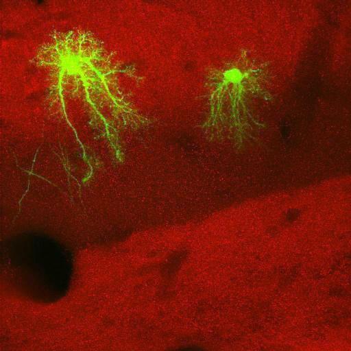  NCBI Organism:Rattus norvegicus; Cell Types:astrocyte, astrocyte of the hippocampus; Cell Components:cell projection cytoplasm, cell body; Biological process:forebrain astrocyte development