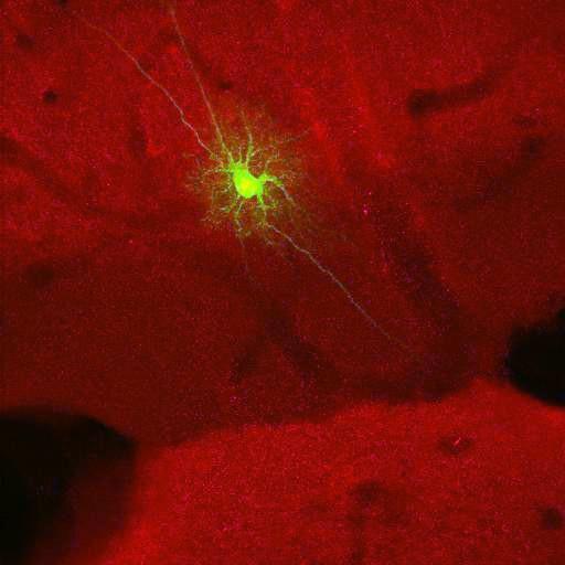  NCBI Organism:Rattus norvegicus; Cell Types:astrocyte, astrocyte of the hippocampus; Cell Components:cell projection cytoplasm, cell body; Biological process:forebrain astrocyte development