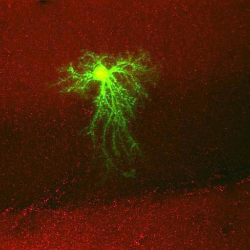  NCBI Organism:Rattus norvegicus; Cell Types:astrocyte, astrocyte of the hippocampus; Cell Components:cell projection cytoplasm, cell body; Biological process:forebrain astrocyte development