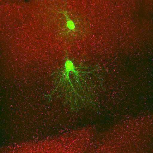  NCBI Organism:Rattus norvegicus; Cell Types:astrocyte, astrocyte of the hippocampus; Cell Components:cell projection cytoplasm, cell body; Biological process:forebrain astrocyte development