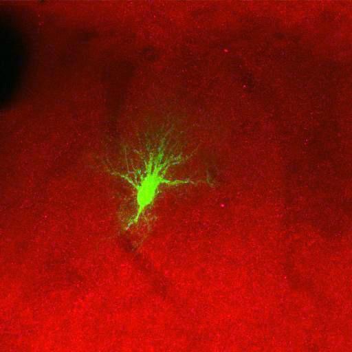  NCBI Organism:Rattus norvegicus; Cell Types:astrocyte, astrocyte of the hippocampus; Cell Components:cell projection cytoplasm, cell body; Biological process:forebrain astrocyte development