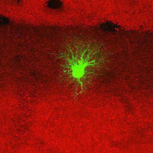  NCBI Organism:Rattus norvegicus; Cell Types:astrocyte, astrocyte of the hippocampus; Cell Components:cell projection cytoplasm, cell body; Biological process:forebrain astrocyte development