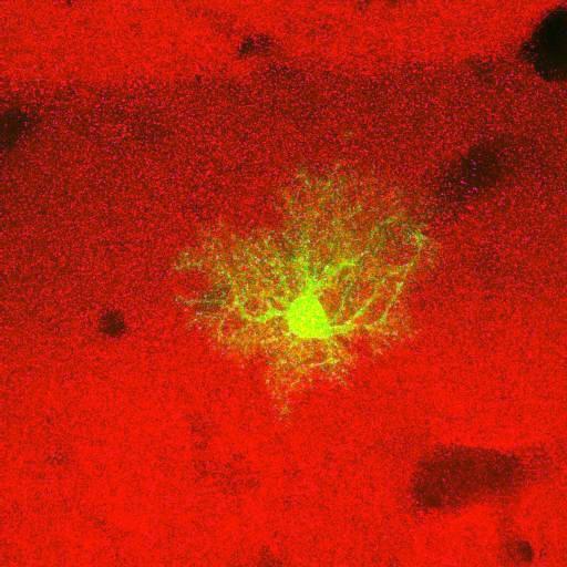  NCBI Organism:Rattus norvegicus; Cell Types:astrocyte, astrocyte of the hippocampus; Cell Components:cell projection cytoplasm, cell body; Biological process:forebrain astrocyte development