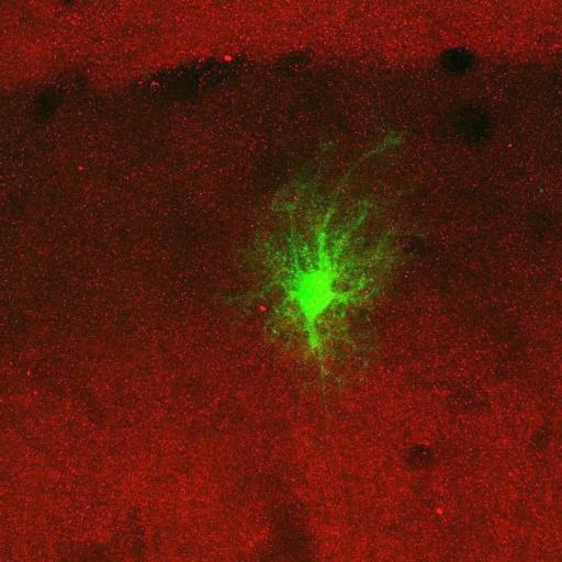  NCBI Organism:Rattus norvegicus; Cell Types:astrocyte, astrocyte of the hippocampus; Cell Components:cell projection cytoplasm, cell body; Biological process:forebrain astrocyte development