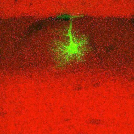  NCBI Organism:Rattus norvegicus; Cell Types:astrocyte, astrocyte of the hippocampus; Cell Components:cell projection cytoplasm, cell body; Biological process:forebrain astrocyte development