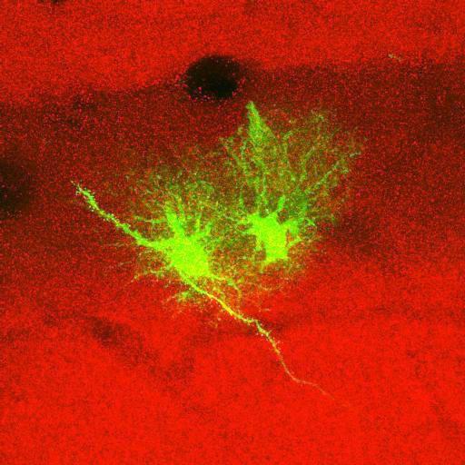  NCBI Organism:Rattus norvegicus; Cell Types:astrocyte, astrocyte of the hippocampus; Cell Components:cell projection cytoplasm, cell body; Biological process:forebrain astrocyte development