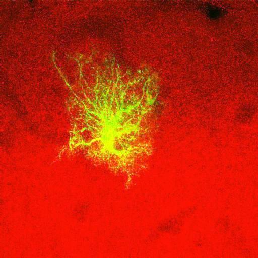  NCBI Organism:Rattus norvegicus; Cell Types:astrocyte, astrocyte of the hippocampus; Cell Components:cell projection cytoplasm, cell body; Biological process:forebrain astrocyte development