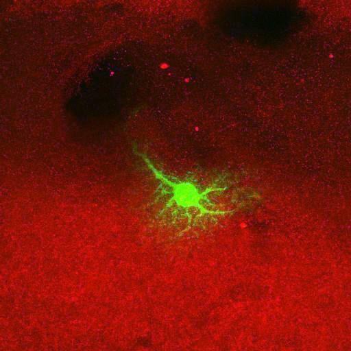  NCBI Organism:Rattus norvegicus; Cell Types:astrocyte, astrocyte of the hippocampus; Cell Components:cell projection cytoplasm, cell body; Biological process:forebrain astrocyte development