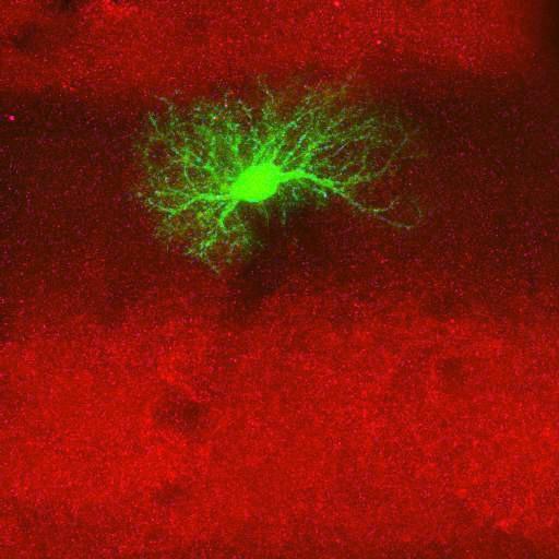  NCBI Organism:Rattus norvegicus; Cell Types:astrocyte, astrocyte of the hippocampus; Cell Components:cell projection cytoplasm, cell body; Biological process:forebrain astrocyte development