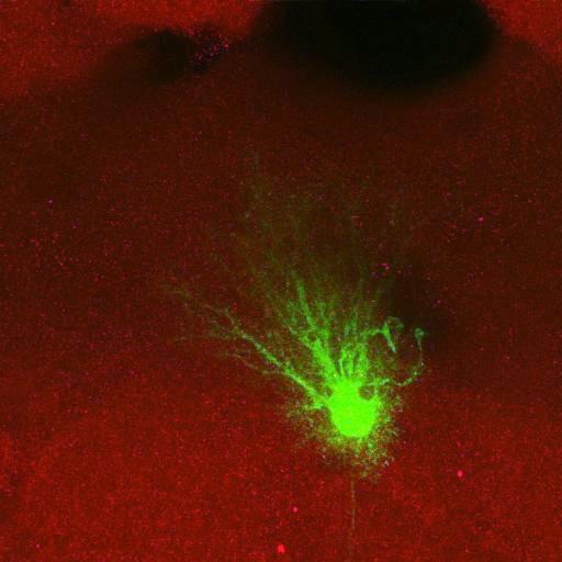  NCBI Organism:Rattus norvegicus; Cell Types:astrocyte, astrocyte of the hippocampus; Cell Components:cell projection cytoplasm, cell body; Biological process:forebrain astrocyte development