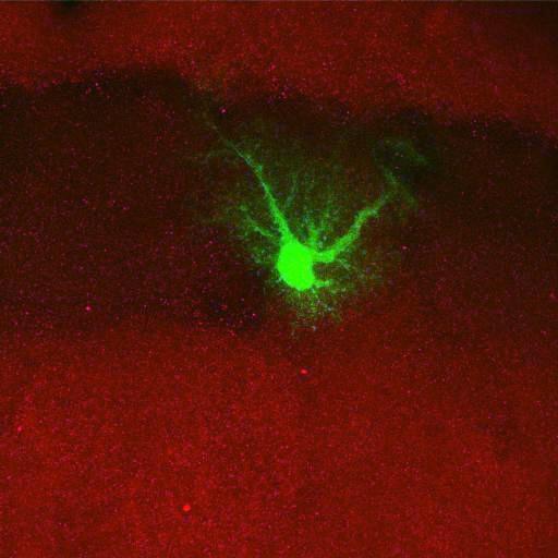  NCBI Organism:Rattus norvegicus; Cell Types:astrocyte, astrocyte of the hippocampus; Cell Components:cell projection cytoplasm, cell body; Biological process:forebrain astrocyte development