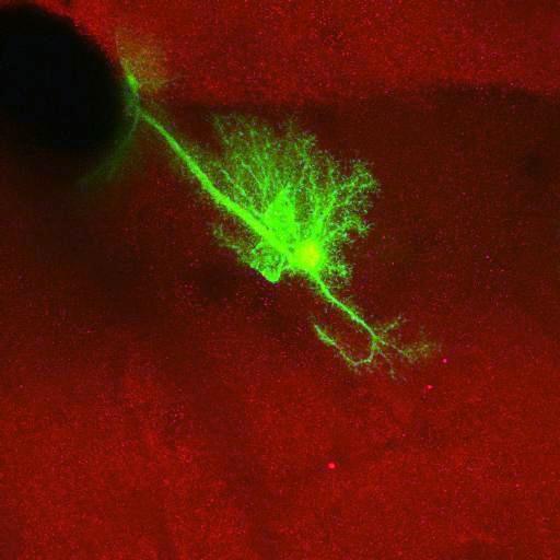  NCBI Organism:Rattus norvegicus; Cell Types:astrocyte, astrocyte of the hippocampus; Cell Components:cell projection cytoplasm, cell body; Biological process:forebrain astrocyte development