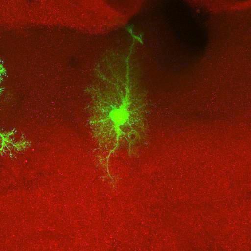  NCBI Organism:Rattus norvegicus; Cell Types:astrocyte, astrocyte of the hippocampus; Cell Components:cell projection cytoplasm, cell body; Biological process:forebrain astrocyte development