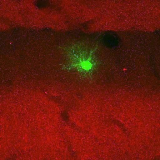  NCBI Organism:Rattus norvegicus; Cell Types:astrocyte, astrocyte of the hippocampus; Cell Components:cell projection cytoplasm, cell body; Biological process:forebrain astrocyte development