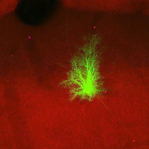  NCBI Organism:Rattus norvegicus; Cell Types:astrocyte, astrocyte of the hippocampus; Cell Components:cell projection cytoplasm, cell body; Biological process:forebrain astrocyte development