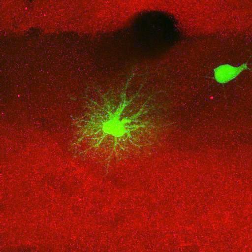  NCBI Organism:Rattus norvegicus; Cell Types:astrocyte, astrocyte of the hippocampus; Cell Components:cell projection cytoplasm, cell body; Biological process:forebrain astrocyte development