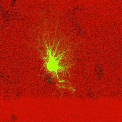  NCBI Organism:Rattus norvegicus; Cell Types:astrocyte, astrocyte of the hippocampus; Cell Components:cell projection cytoplasm, cell body; Biological process:forebrain astrocyte development