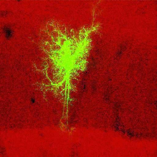  NCBI Organism:Rattus norvegicus; Cell Types:astrocyte, astrocyte of the hippocampus; Cell Components:cell projection cytoplasm, cell body; Biological process:forebrain astrocyte development