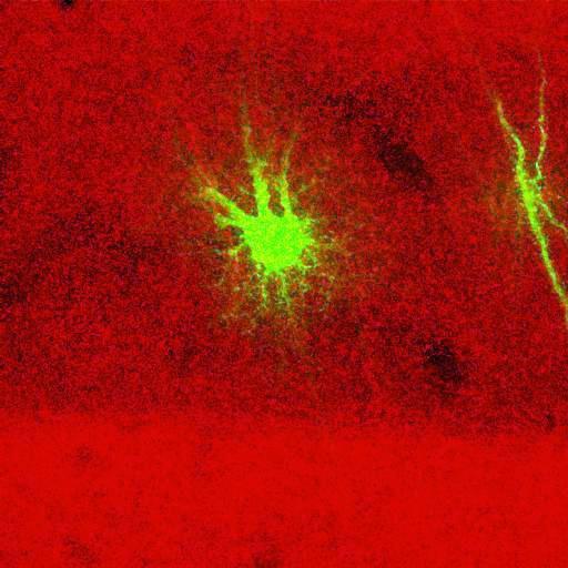  NCBI Organism:Rattus norvegicus; Cell Types:astrocyte, astrocyte of the hippocampus; Cell Components:cell projection cytoplasm, cell body; Biological process:forebrain astrocyte development