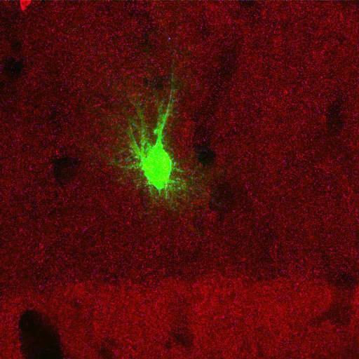  NCBI Organism:Rattus norvegicus; Cell Types:astrocyte, astrocyte of the hippocampus; Cell Components:cell projection cytoplasm, cell body; Biological process:forebrain astrocyte development