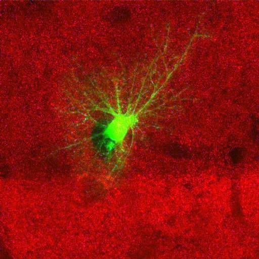  NCBI Organism:Rattus norvegicus; Cell Types:astrocyte, astrocyte of the hippocampus; Cell Components:cell projection cytoplasm, cell body; Biological process:forebrain astrocyte development