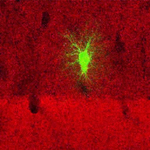  NCBI Organism:Rattus norvegicus; Cell Types:astrocyte, astrocyte of the hippocampus; Cell Components:cell projection cytoplasm, cell body; Biological process:forebrain astrocyte development