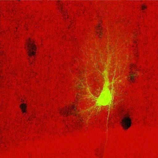  NCBI Organism:Rattus norvegicus; Cell Types:astrocyte, astrocyte of the hippocampus; Cell Components:cell projection cytoplasm, cell body; Biological process:forebrain astrocyte development